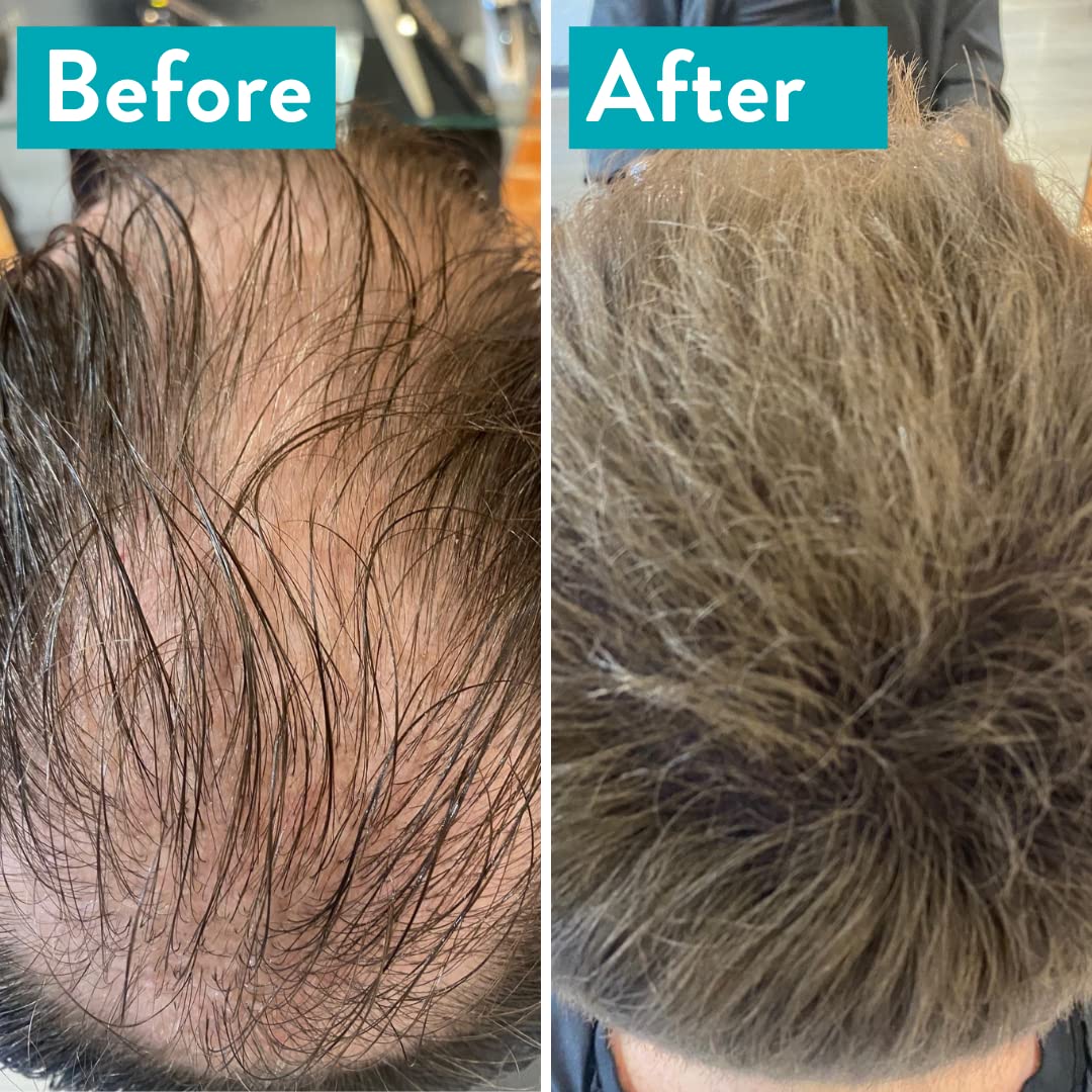 MR Hair Building Fibres Dark Brown 15g. Disguise and Cover up Thinning