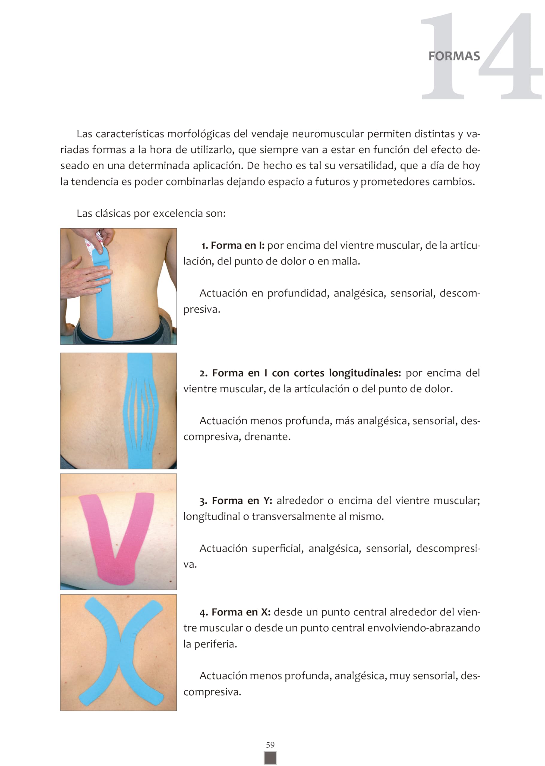 VENDAJE NEUROMUSCULAR KINESIOTAPE EN FISIOTERAPIA
