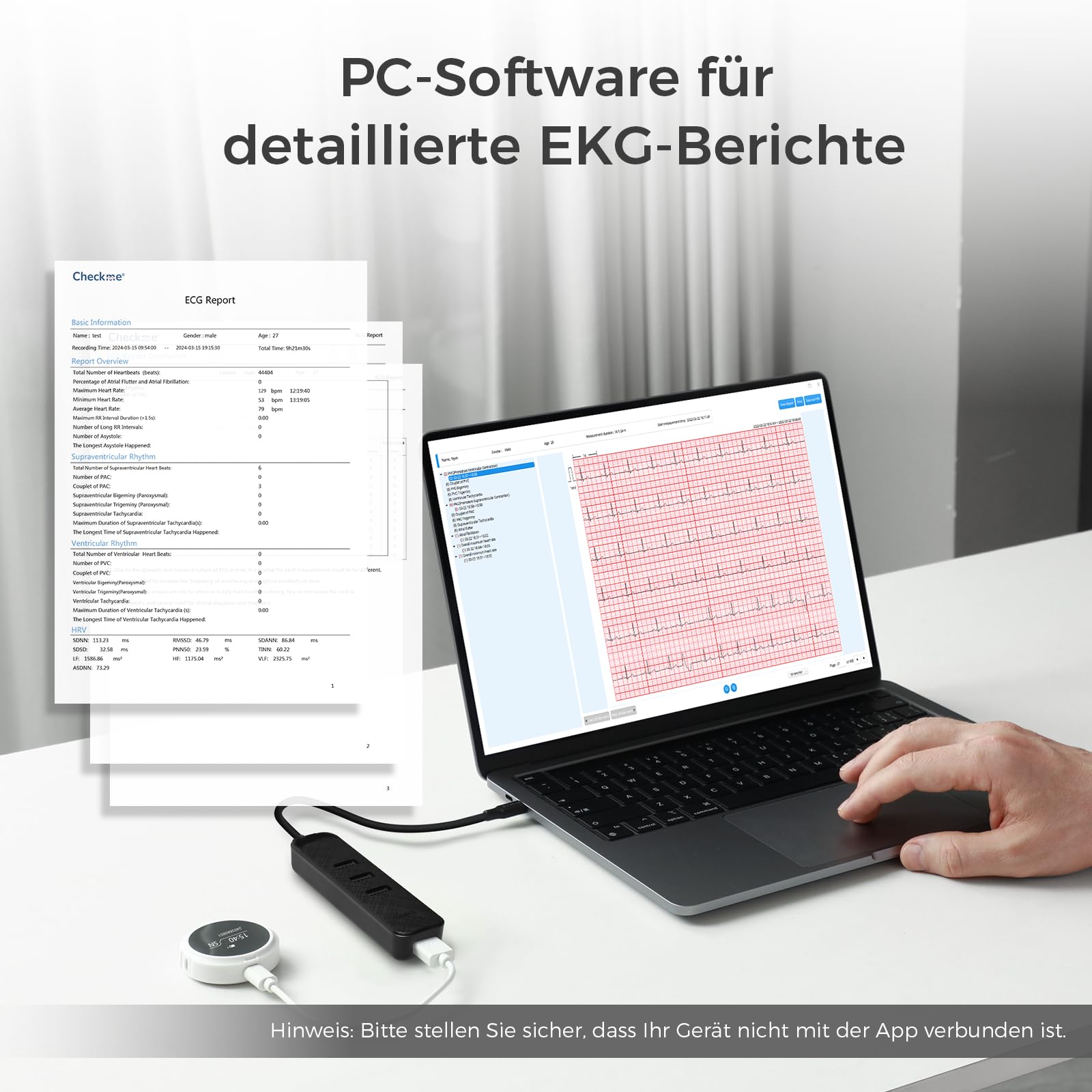 CheckMe LepodPro 10-Elektroden EKG Gerät 12 Kanal, 24h Langzeit-EKG Gerät für Zuhause, AI Analyse von 17 Arrhythmien, OLED-Display & 72h Akku