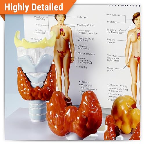 Miniatura 2 de Modelo de enfermedad de la tiroides G315