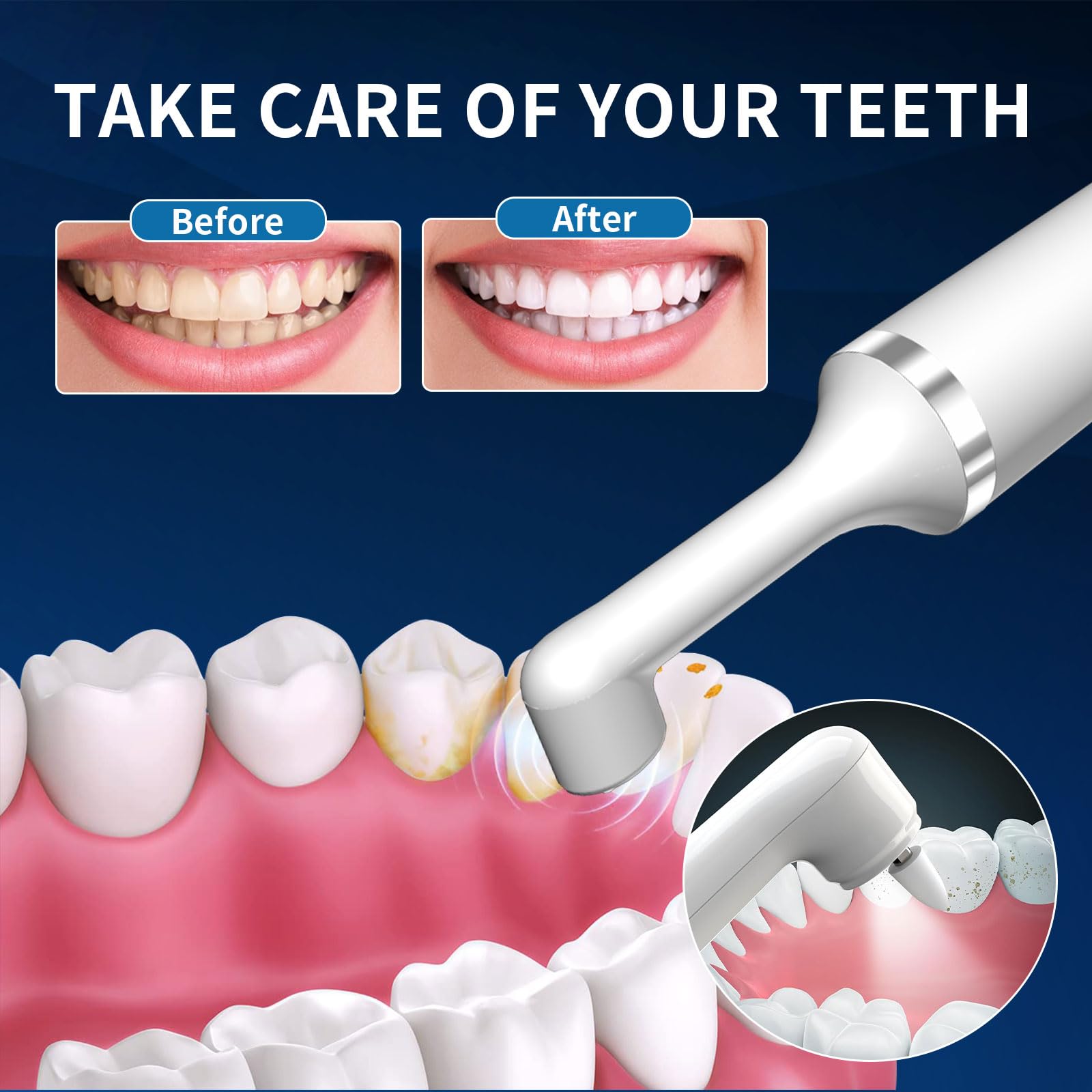 Pulidor de dientes, removedor de placa para blanqueamiento de dientes, herramientas dentales, kit de limpieza de dientes eléctrico con luz LED, 5 modos de velocidad con 5 cabezales de cepillo de