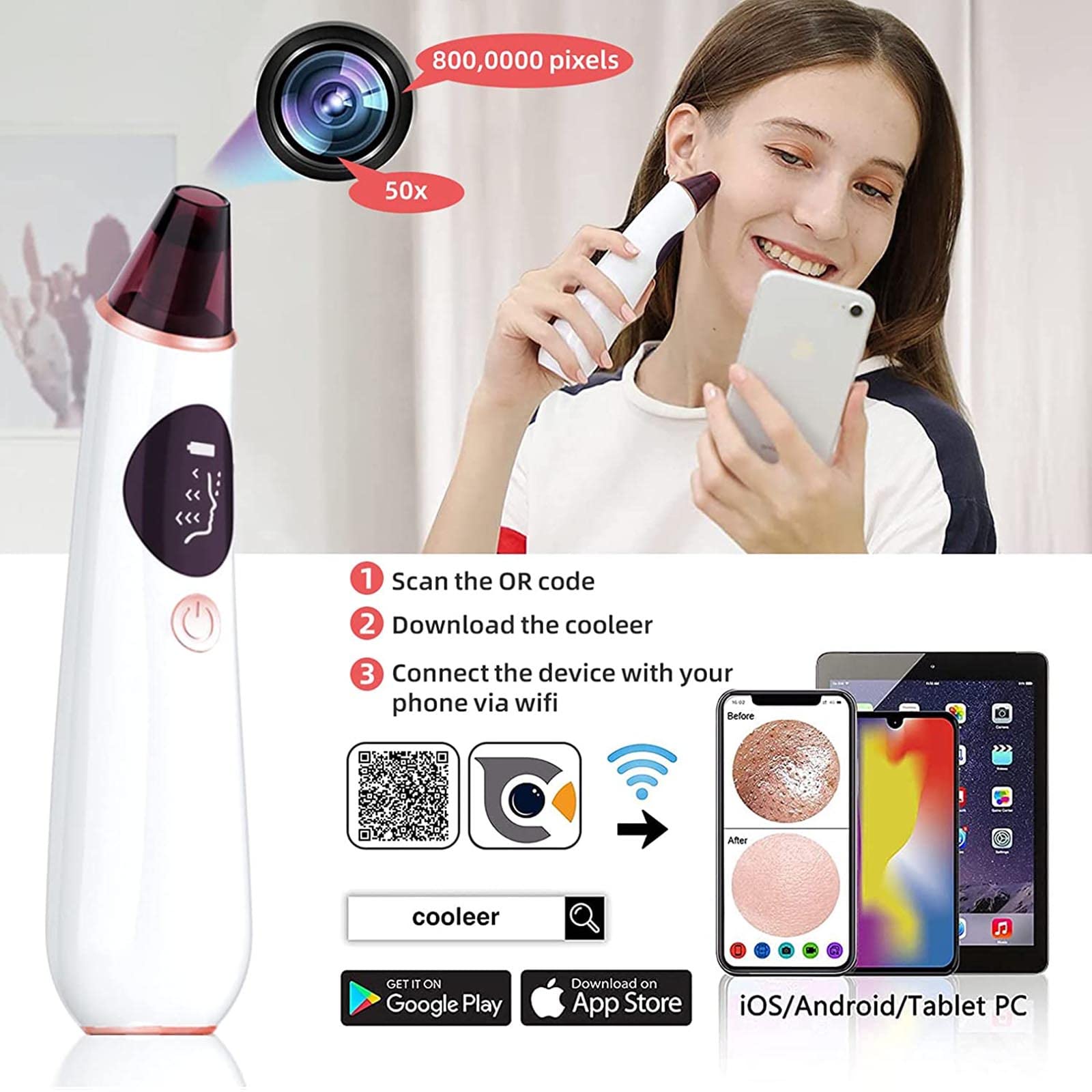 Herramienta de succión de puntos negros – Aspirador de poros para eliminar puntos negros, limpiador eléctrico de poros facial, limpiador de poros faciales, herramienta extractora de puntos blancos de