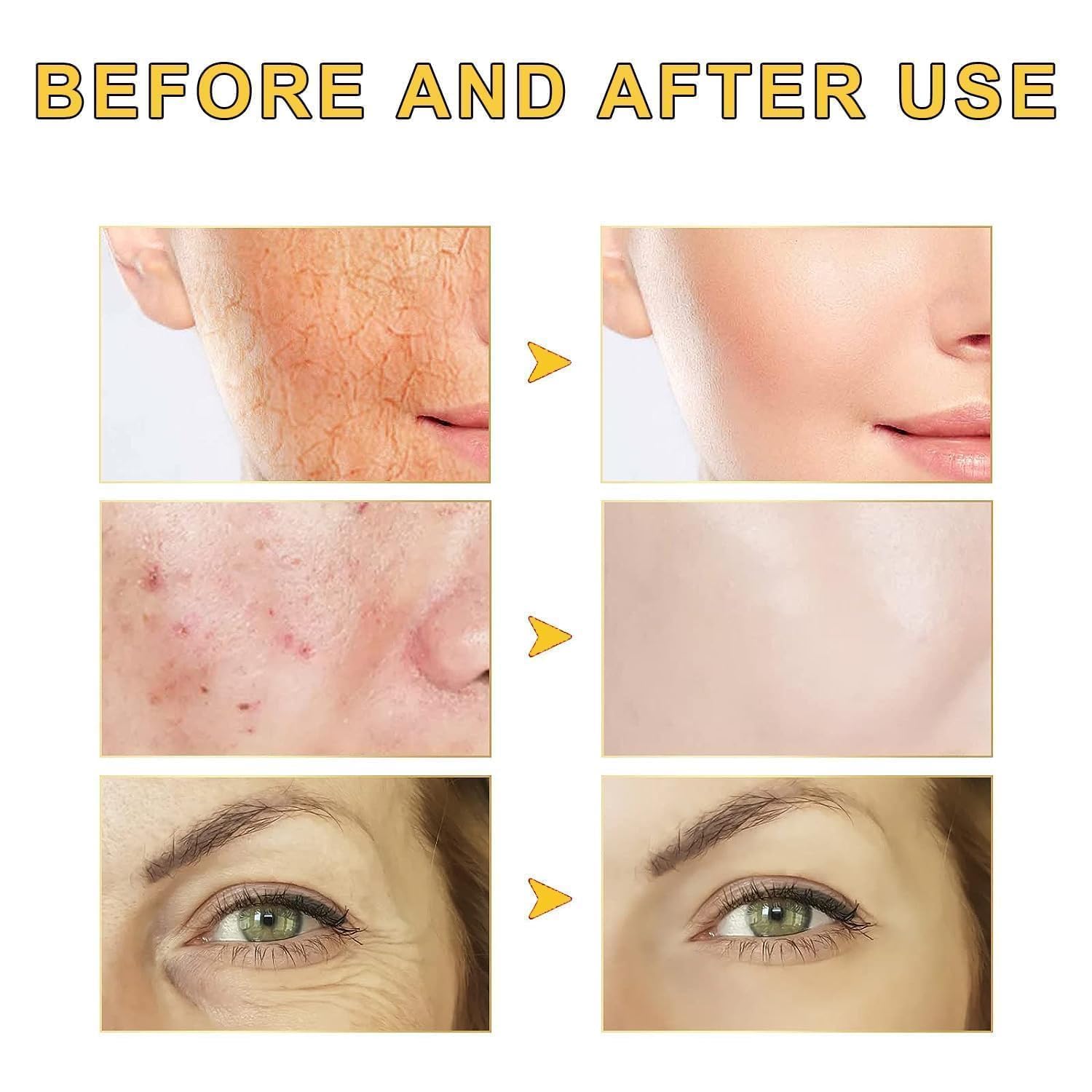 2PCS GOCAYRRY Advanced Snail Mucin 96% Power Repairing Essence, Snail Mucin 96% - Anti-Aging Serum, With Snail Secretion Filtrate For Dull (02) - Image 2