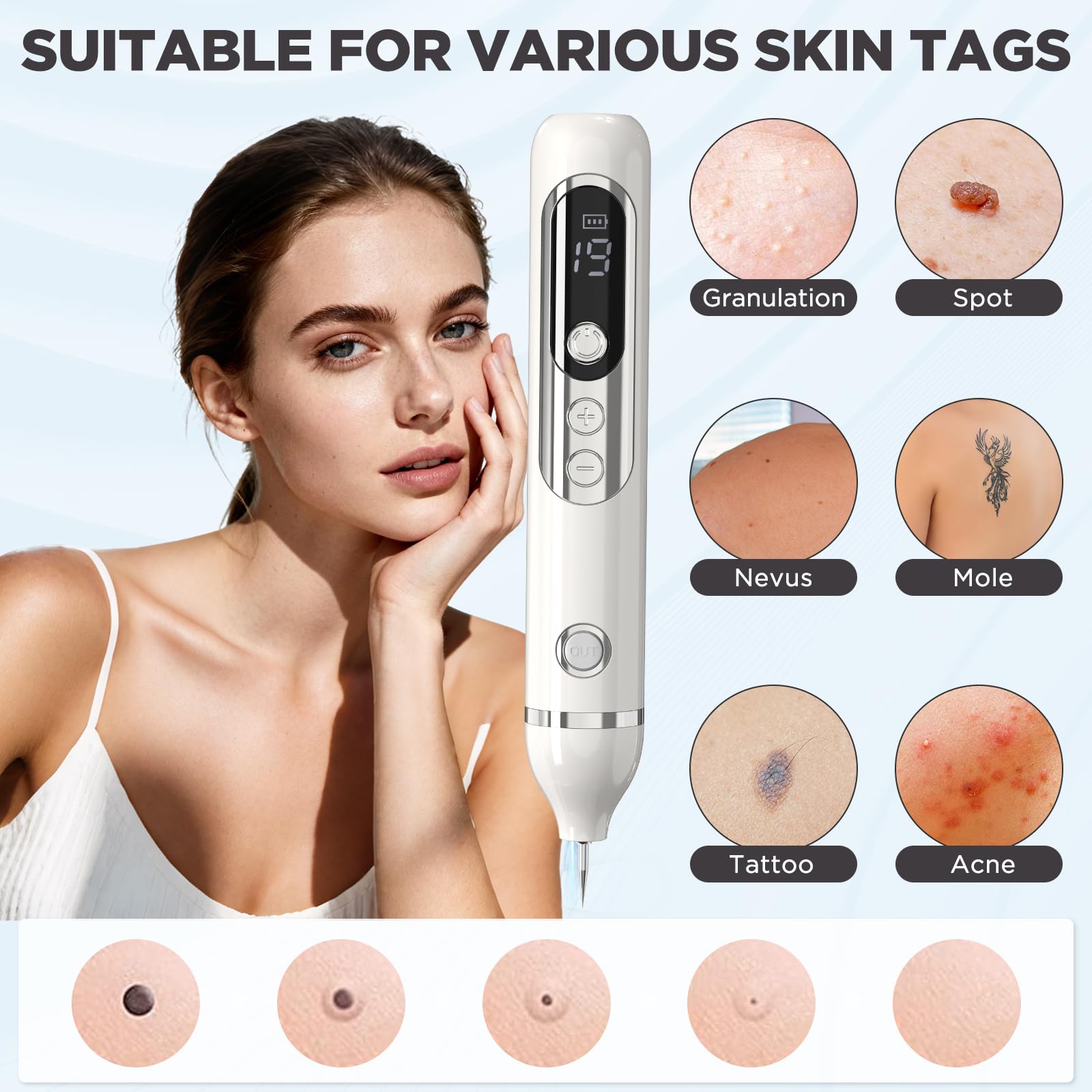 Eliminar Verrugas, Lápiz Para Eliminar Verrugas Cutáneas Lápiz Para Eliminar Lunares con Plasma 19 Niveles De Intensidad y Luz LCD Aguja Reemplazable para Rostro Cuerpo Verrugas Pecas Nevos