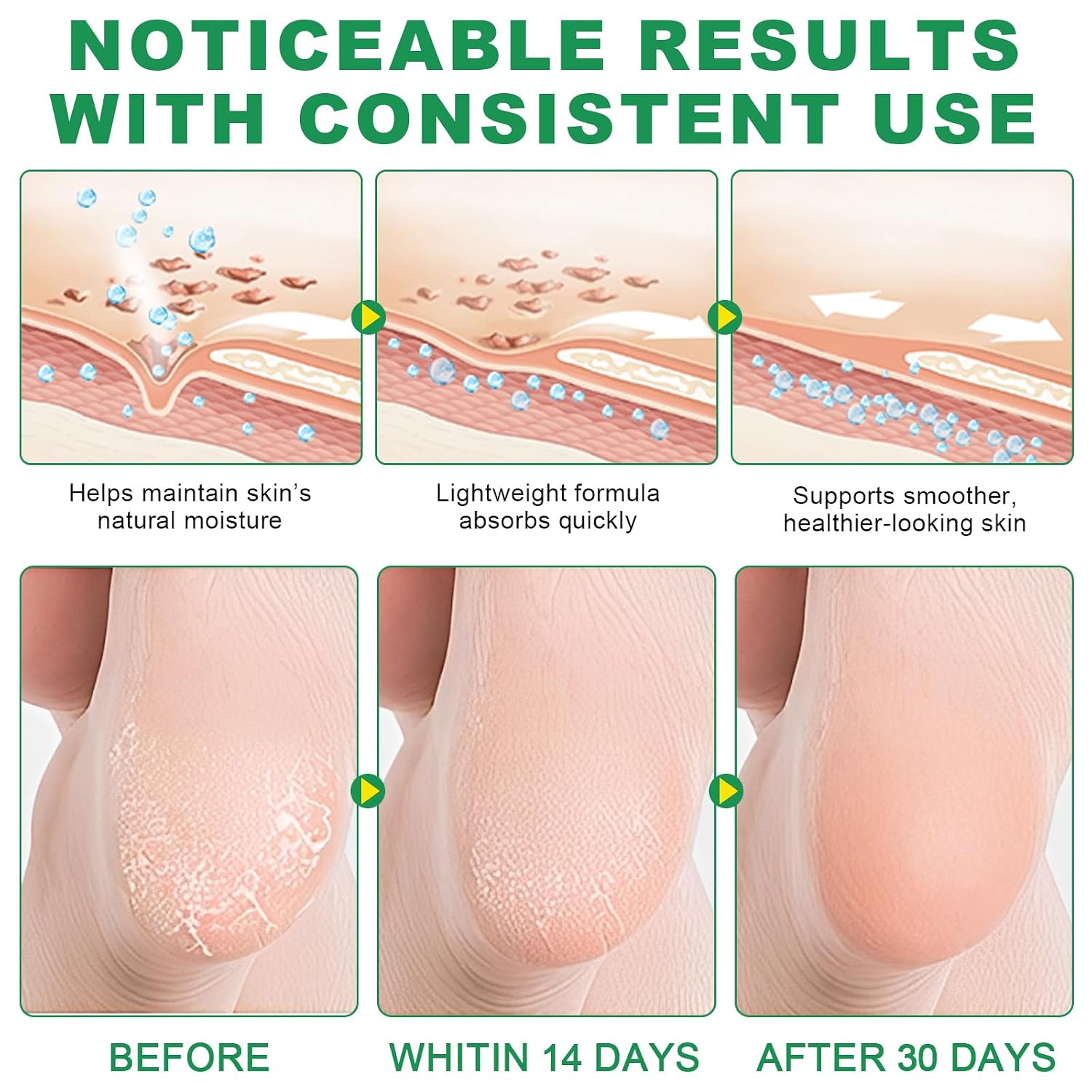 60% Urea Cream with 2% Salicylic Acid & Aloe vera Cracked Heel Stick, Long-lasting Moisture, Repair Cracked Heels, Deep Moisturizing Heel Balm with Aloe Vera, Coconut Oil, Tea Tree Oil, 1.41 oz / 2PCS