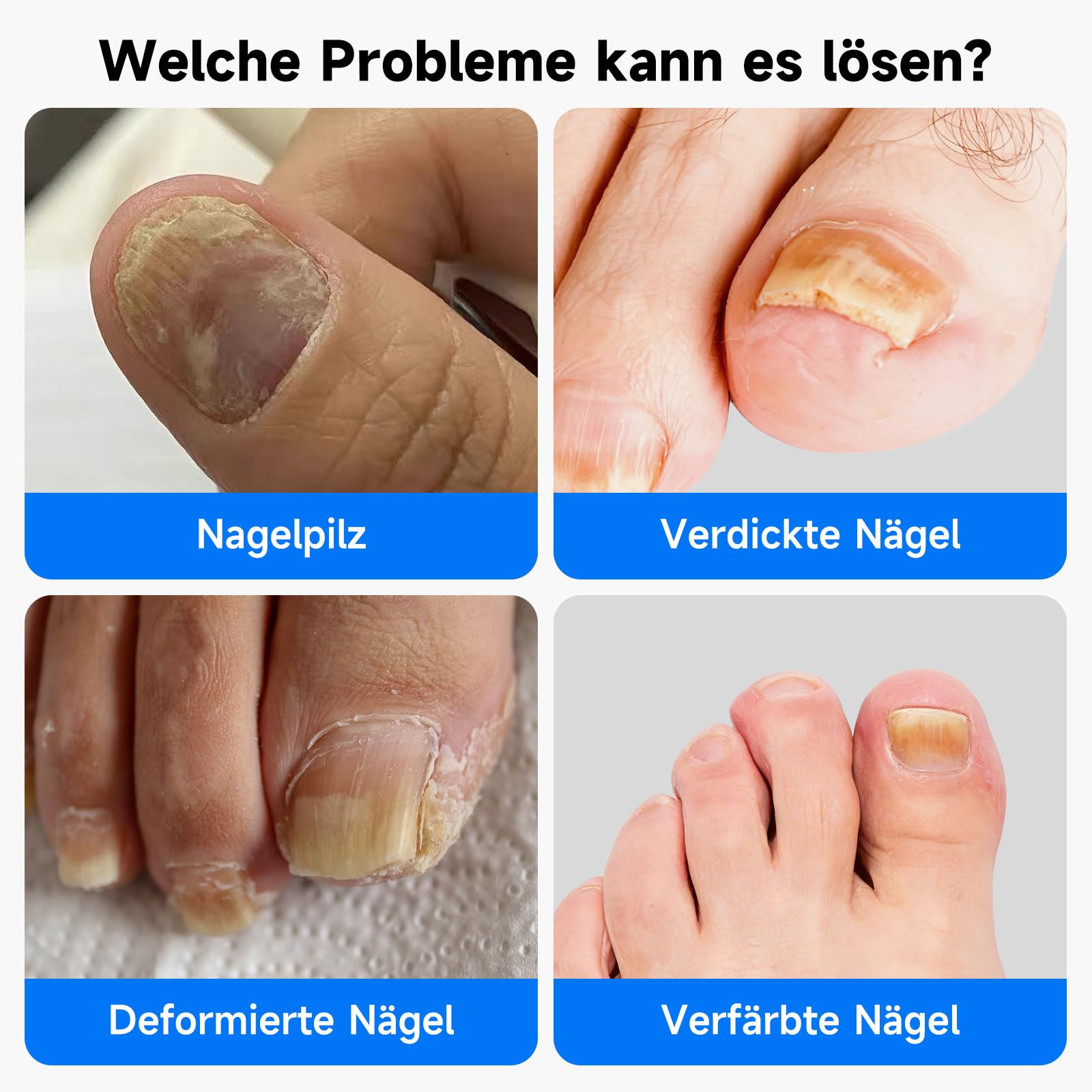 Nagelpflege Gerät für mehrere Zehennägel & Fingernägel, Nagelreinigungs und Pflegegerät mit timer