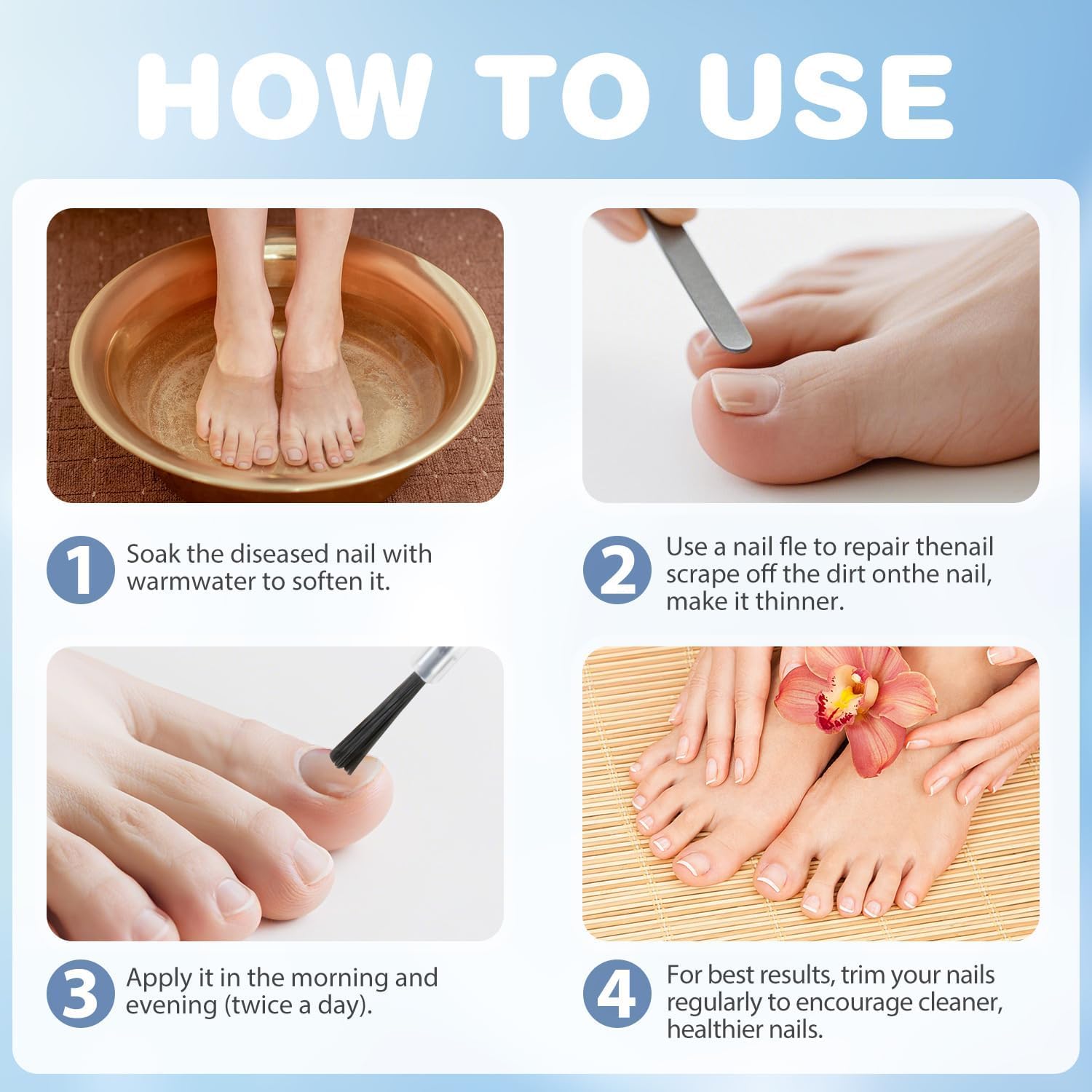 Traitement Mycose Ongles Des Pieds – Solution Puissante En Flacon De 10 Ml