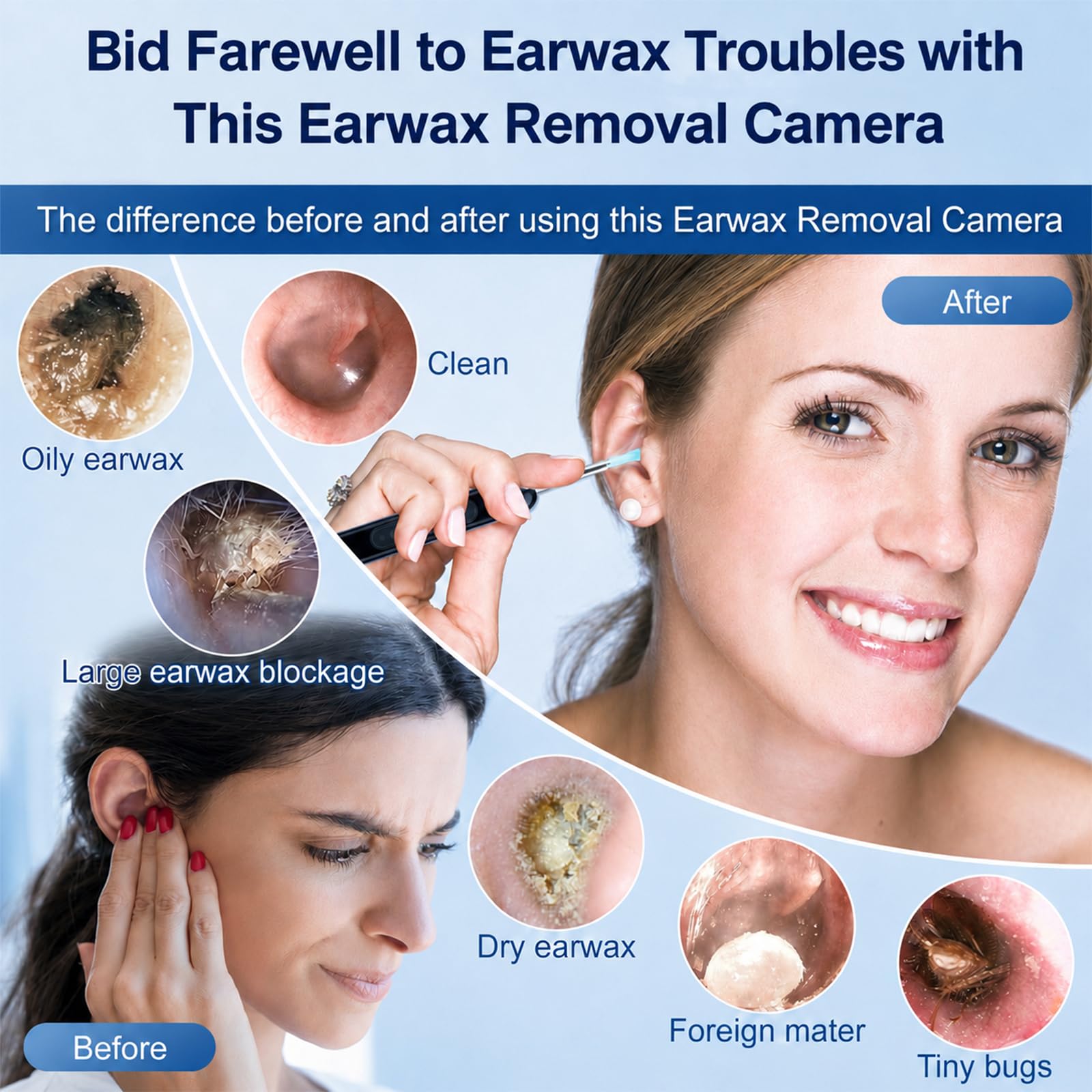 Ear Wax Removal with Camera 1080P HD, IP67 Waterproof Black — Amazon image 5