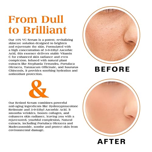Miniatura 7 de Sefralls Suero facial Duo  Retinol Vitamina C  Set de cuidado de la piel antienvejecimiento para mujeres, antiarrugas, piel suave y firme  1 onza