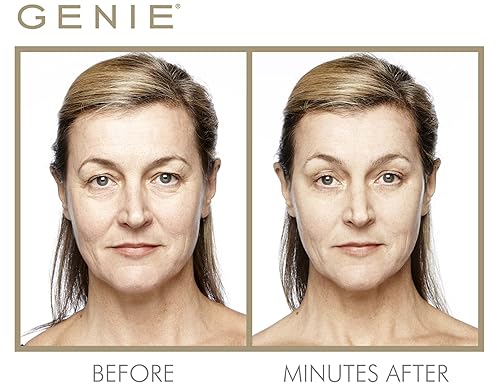 Miniatura 4 de Corrector de líneas de expresión instantáneo