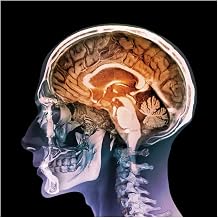 iCanvas Human Head, Mri And 3D CT Scans by Science Photo Library