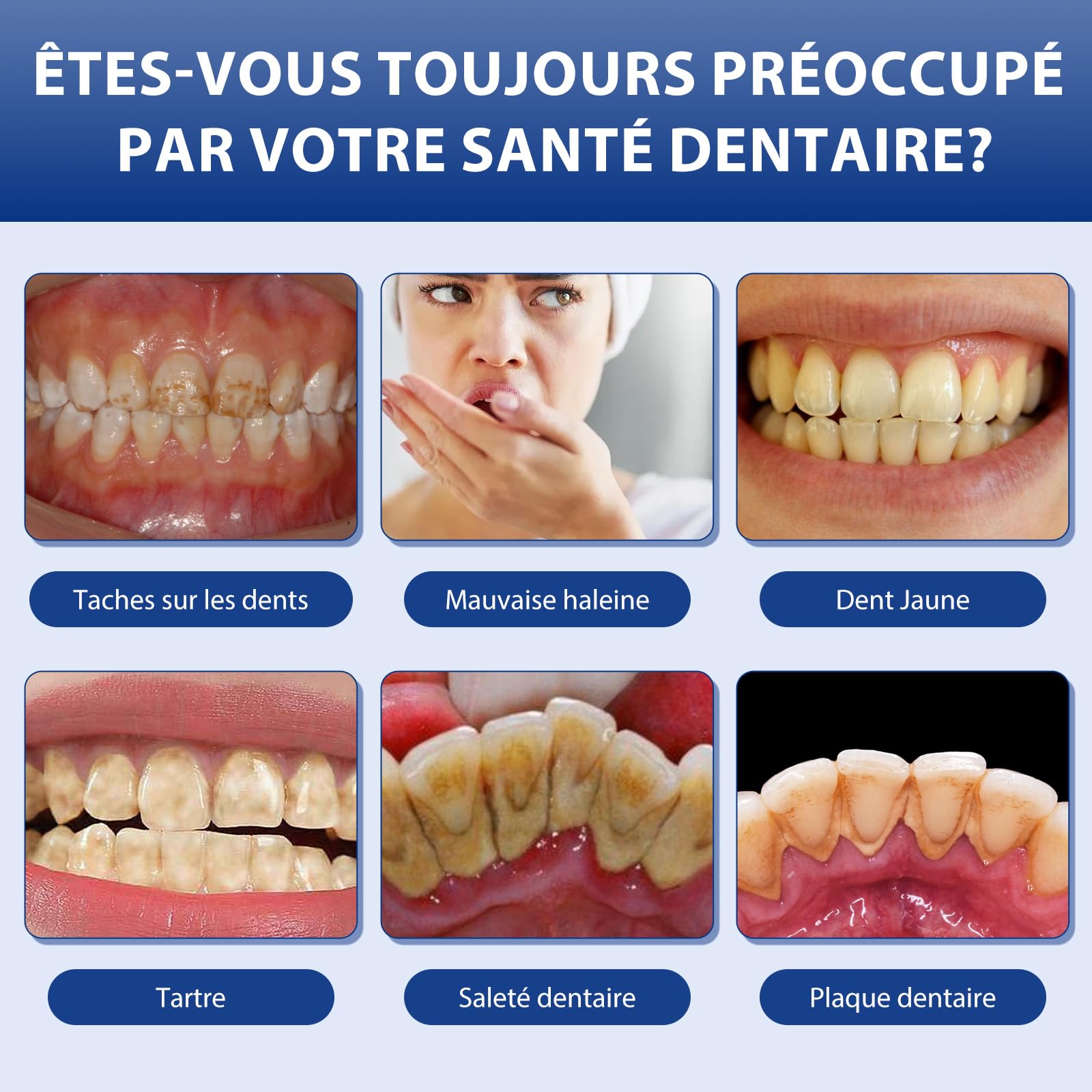 Poudre De Blanchiment Dentaire Professionnelle, Élimine En Profondeur Diverses Taches, Renforce Efficacement Les Dents Et Les Gencives Et Prend Soin En Douceur Des Dents Sensibles