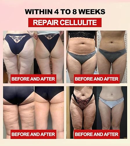 Miniatura 2 de Flouris - Protector de cintura de fibra y ajenjo, entrenador de abdomen Flourish, moldeador de entrenamiento de sudor