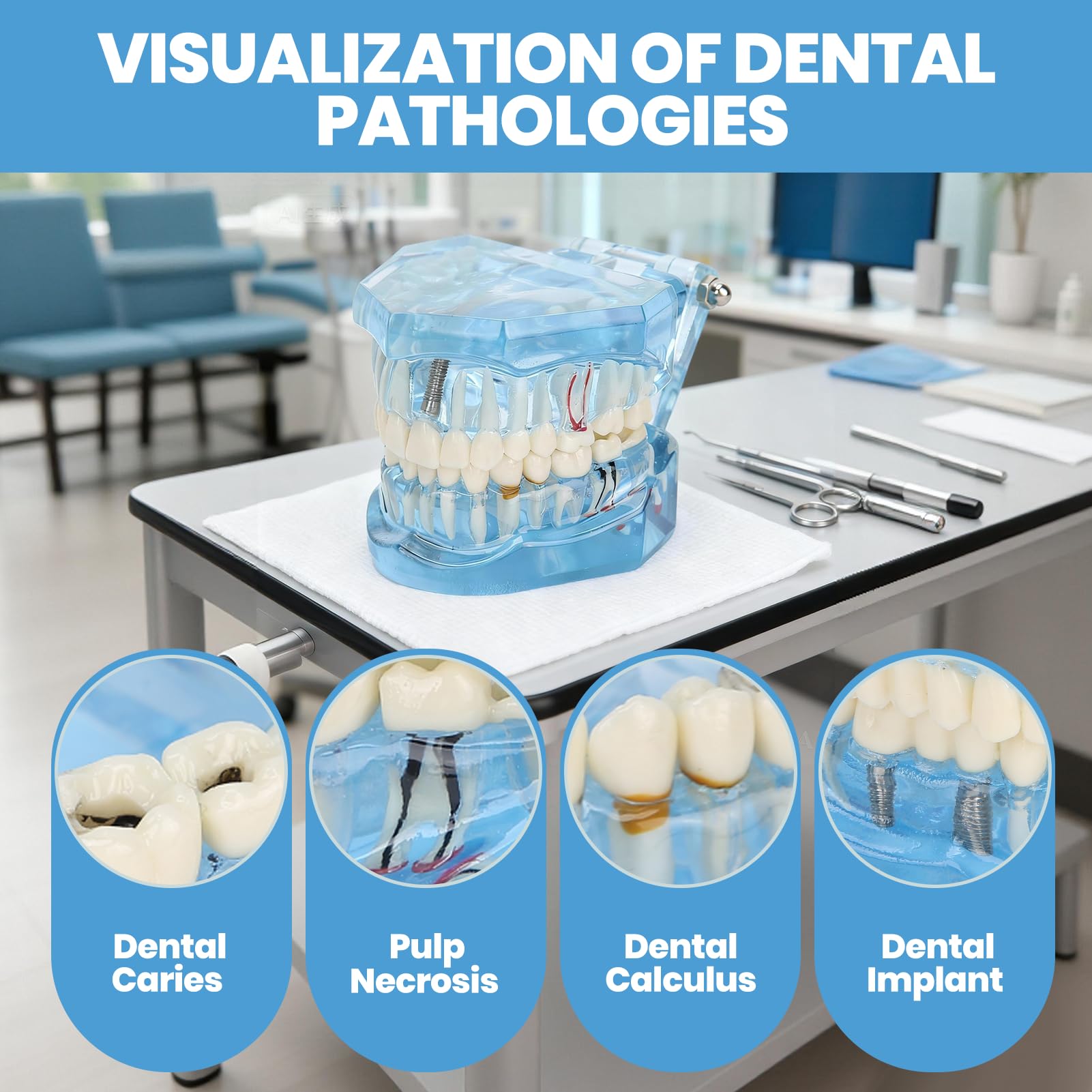 Dentier Modèle D'enseignement, Bleus En Acrylique Transparent Modèle Dentaire, Prothese Dentaire Amovible, Modèle Pathologique pour l'étude et l'éducation
