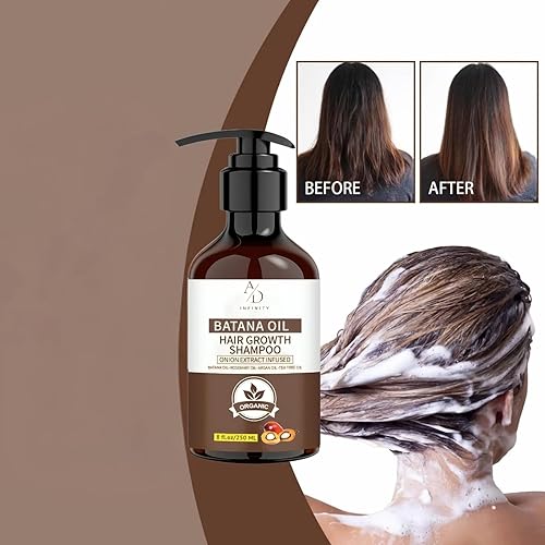Miniatura 8 de Batana Oil - Champú para el crecimiento del cabello, extracto de cebolla infundido, fórmula natural orgánica con aceite de romero y argán, reduce la