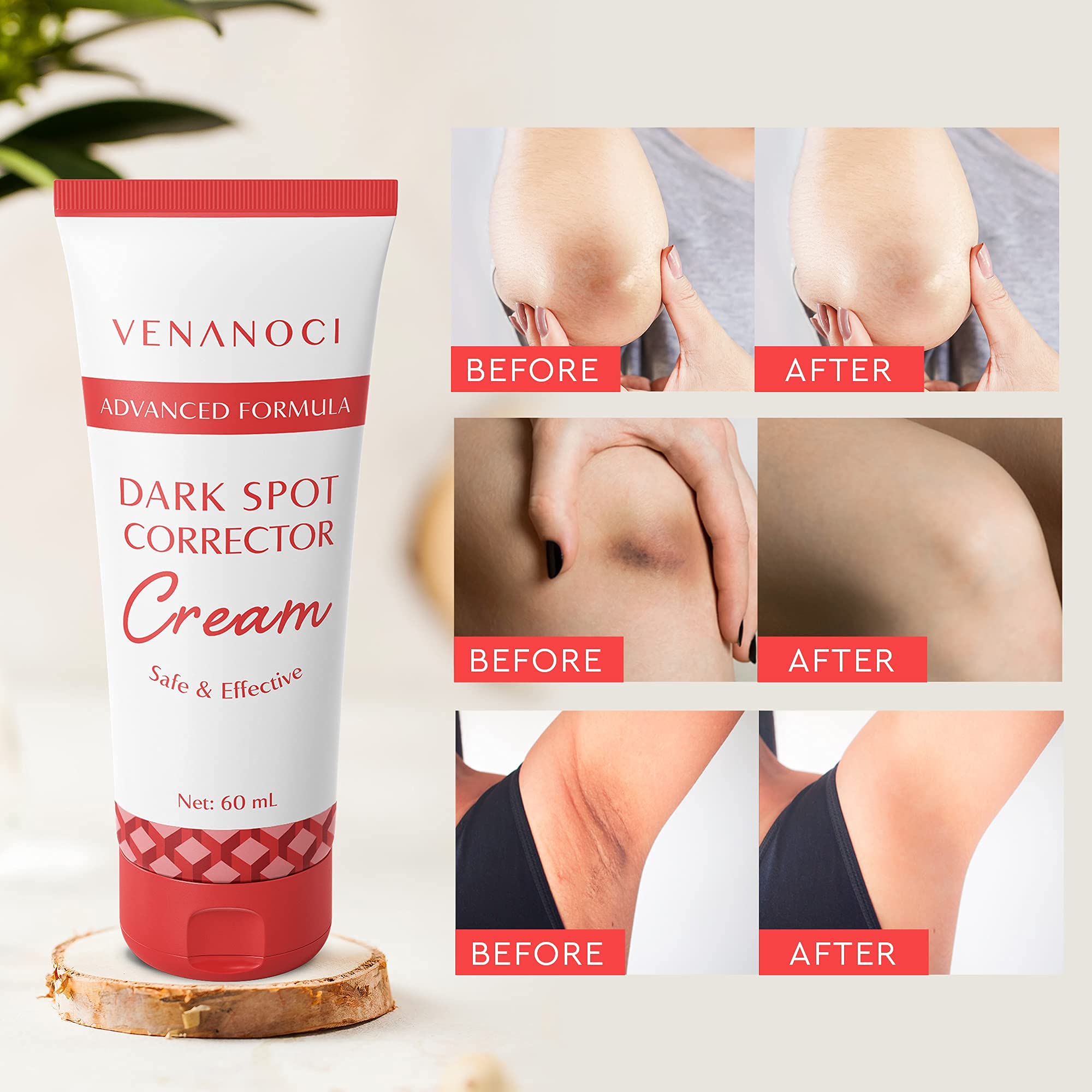 Venanoci Dark Spot Corrector Cream Bikini, Hyperpigmentation, Under Arm Cream, Dark Spot Cream