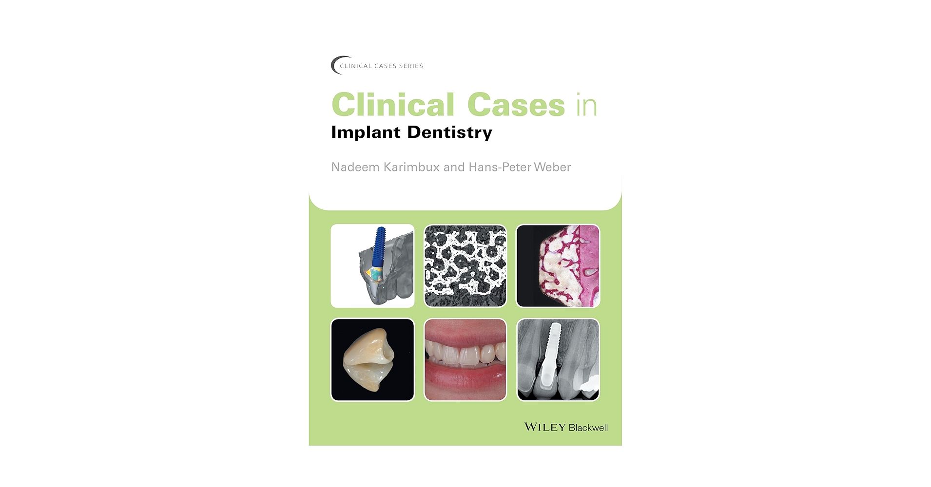 Clinical Cases in Implant Dentistry (Clinical Cases