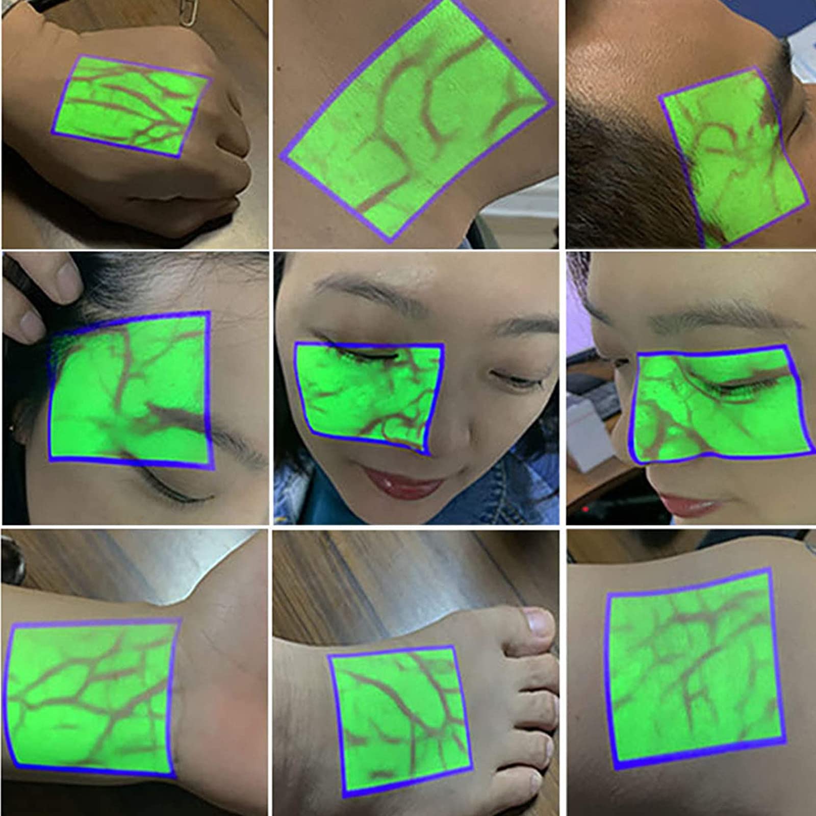 Amazon.co.jp: Vein Finder Viewer、Handheld LED Vein Finder、より
