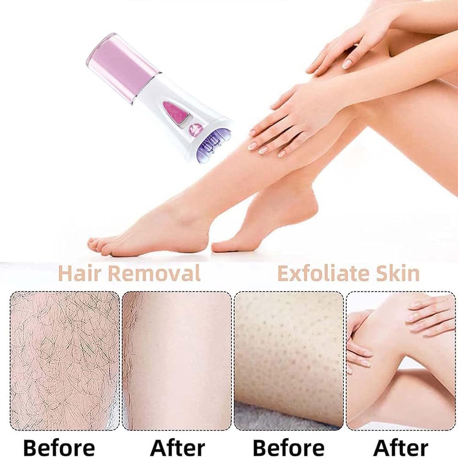 Glabrouse Skin Epilator, 2025 New Glamorous Skin Facial Hair Remover for Women Face, Women's Electric Shaver for Underarm Hair Removal Ladies' Hair Removal Device (Pink-2pc)