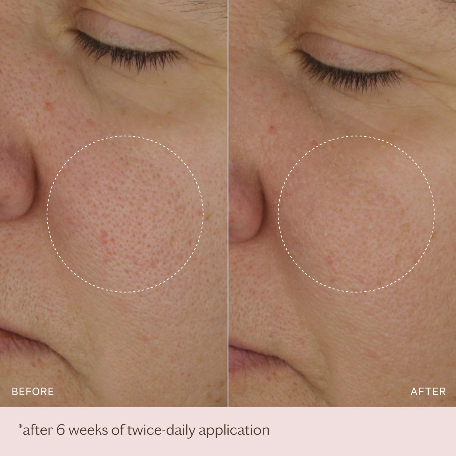 MZ SKIN The Light Moisturiser 1.69 fl oz | Hydrating Anti-Aging Face Cream with Hyaluronic Acid, Bio-Identical Collagen & Peptides | Oil-Free Feel, Firms & Brightens