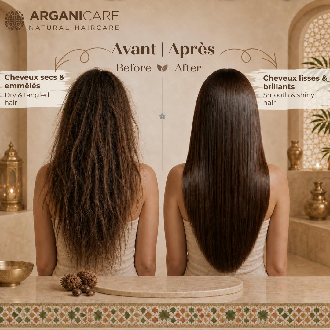 Duo Shampoing + Après-Shampoing à l’Huile de Ricin – Accélérateur de Croissance – Nettoyage en douceur – Tous types de cheveux – 2 x 400 ml
