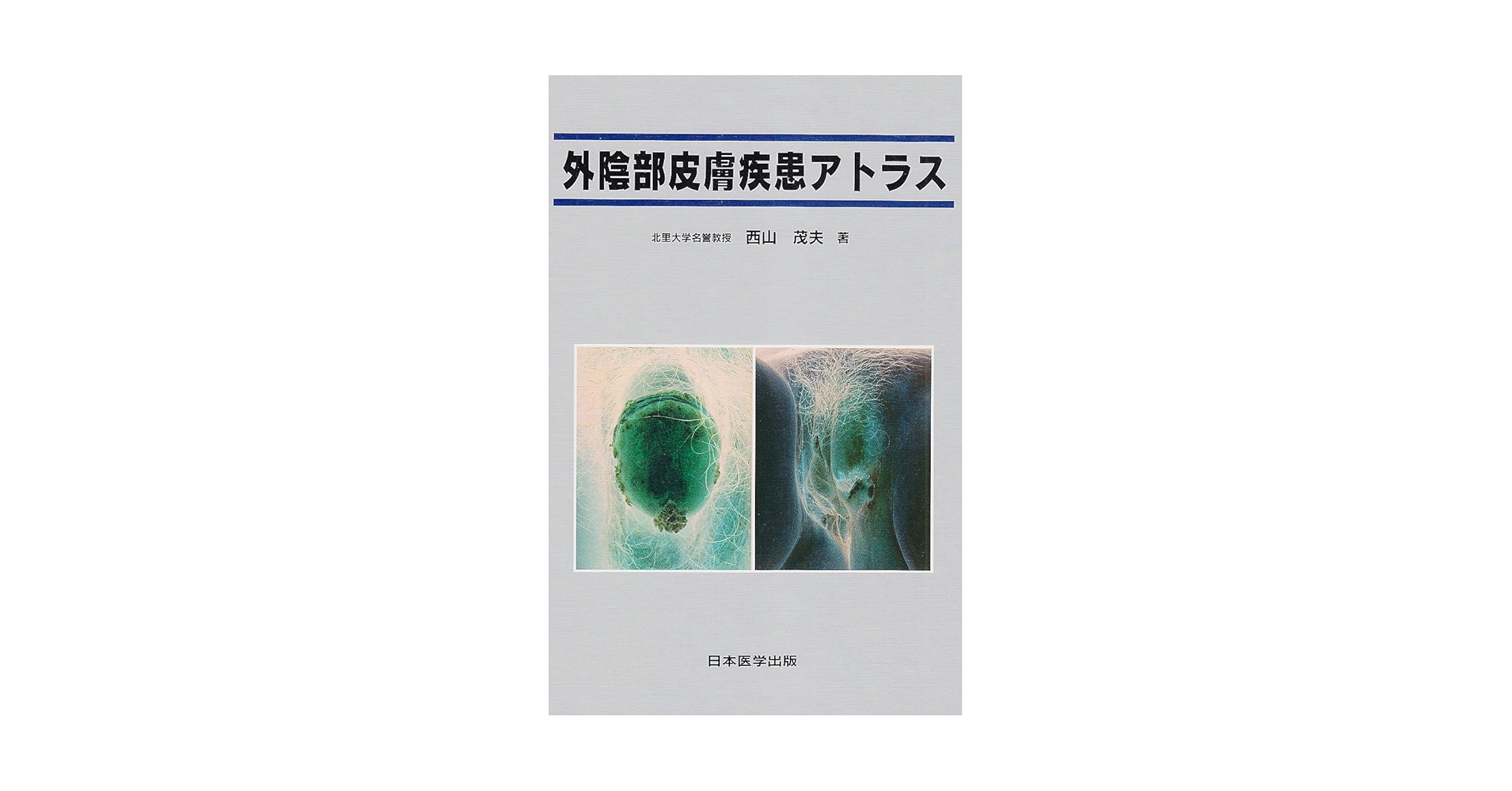 外陰部皮膚疾患アトラス |本 | 通販 | Amazon