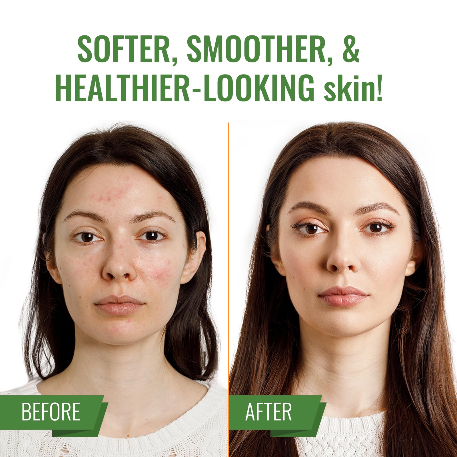 Wild Naturals Manuka Honey Scrub, exfoliante suave y natural para controlar las imperfecciones, limpiador facial no tóxico para acné, eccema, puntos negros, piel seca y sensible E