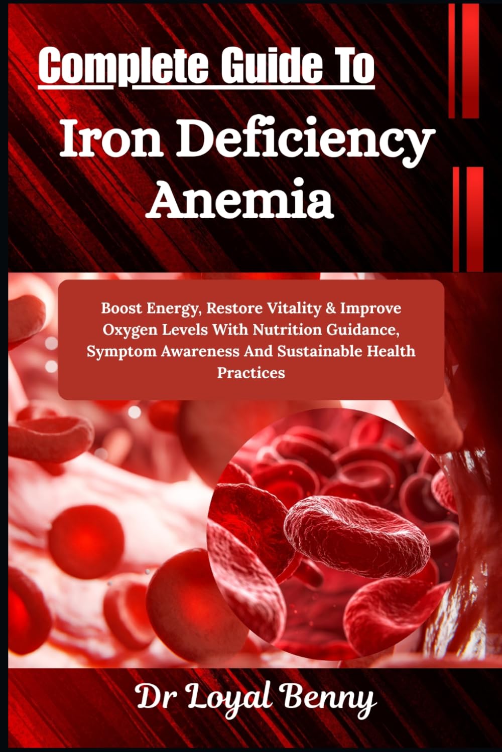 Complete Guide To Iron Deficiency Anemia: Boost Energy, Restore Vitality & Improve Oxygen Levels With Nutrition Guidance, Symptom Awareness And Sustainable Health Practices