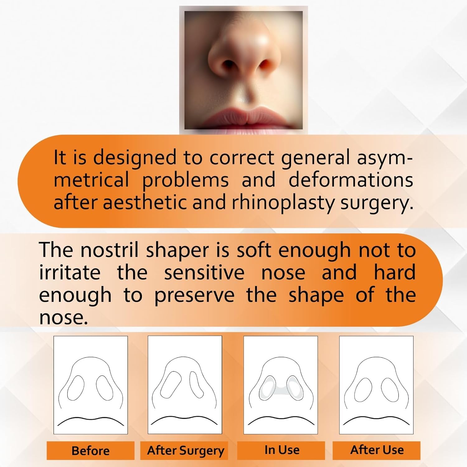 Nostril Retainer, podpórka do nozdrza po plastyce nosa, silikon medyczny, przezroczysty, wiele rozmiarów (9)