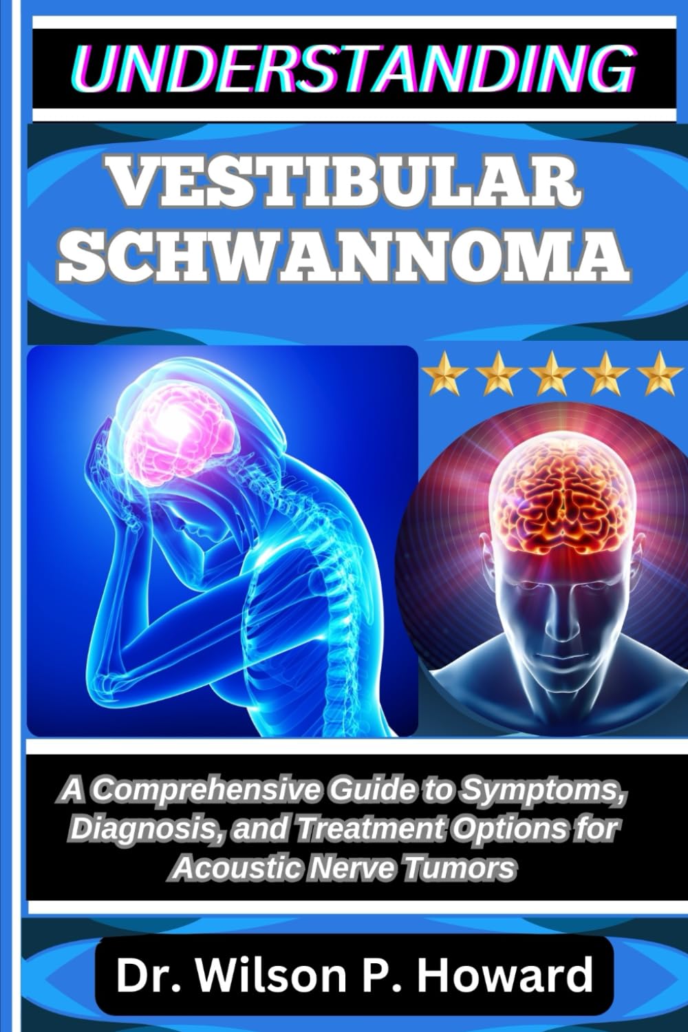 UNDERSTANDING VESTIBULAR SCHWANNOMA: A Comprehensive Guide to Symptoms, Diagnosis, and Treatment Options for Acoustic Nerve Tumors