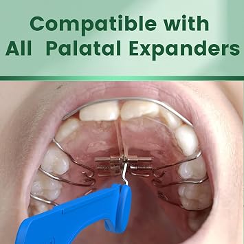 Fremouth Universal Expander Key, Palate Expander Tool for Palatal Expanders