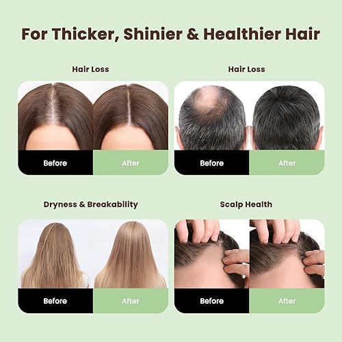 Miniatura 3 de Aceite de batana para el crecimiento del cabello, aceite puro sin refinar para el crecimiento del cabello de Honduras, 100% auténtico y orgánico