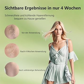 IPL Haarentfernungsgerät schmerzfrei für Damen (Beine Gesicht Bikini) Eispunkt-Kühltechnologie für Arme und Achseln als perfekte Vorbereitung auf den Sommerurlaub