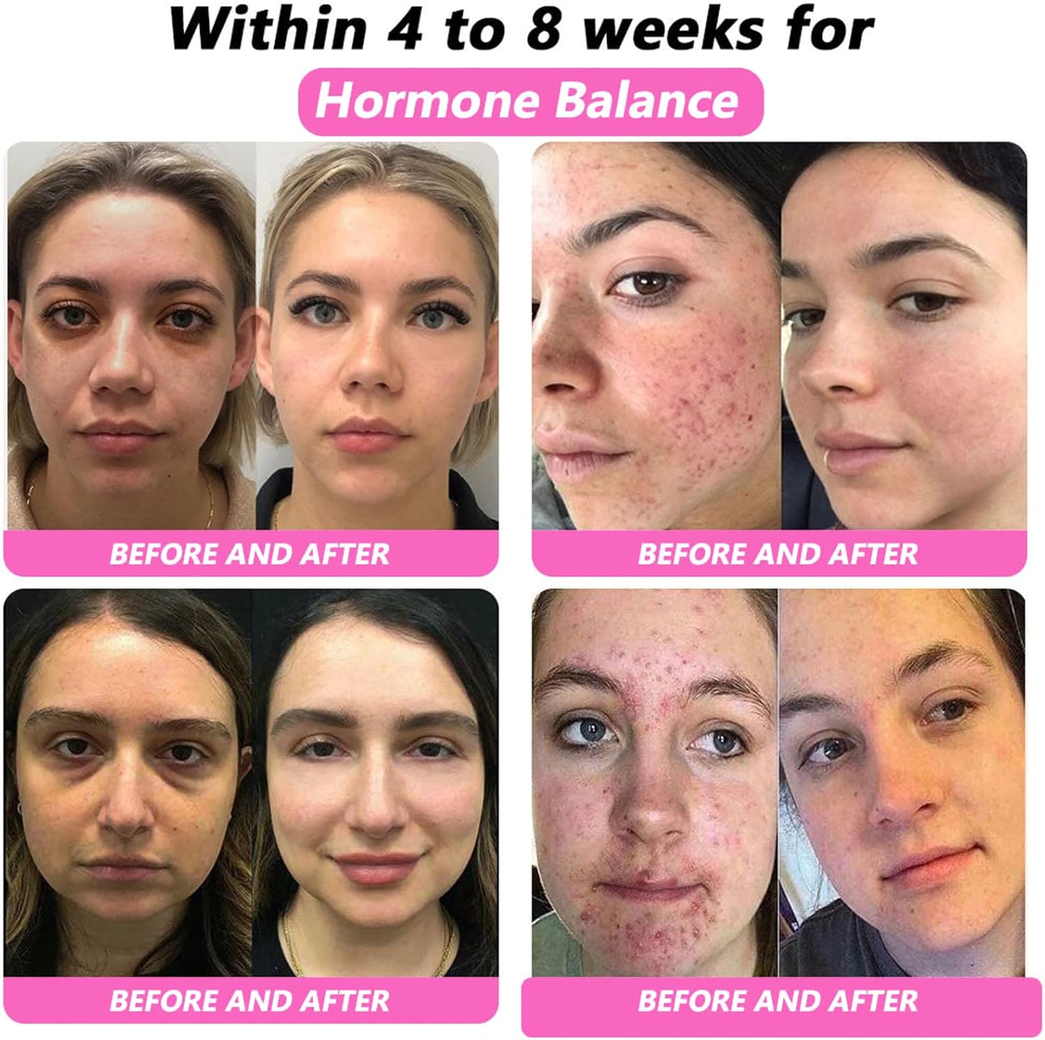 TODAHOF Bee Venom Natural Repair Vaginal Capsules, Professional Bee Venom Vaginal Capsules, TODAHOF Bee Venom Tighten Capsules, Instant Anti-Itch Detox Slimming Products(4 Bottle)