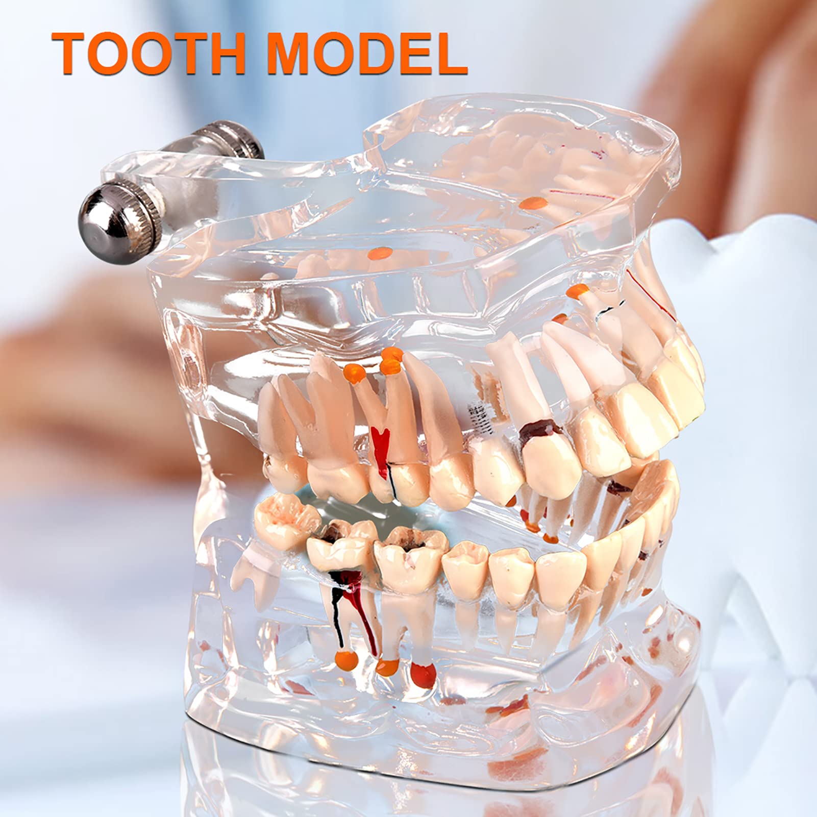 Modelo de Dientes Estándar para Estudiantes de Odontología, Herramienta Educativa Transparente