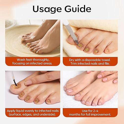 Miniatura 8 de modelones Tratamiento de hongos en las uñas de los pies, extra fuerte, 7 días, tratamiento de hongos en las uñas de los pies y las uñas con