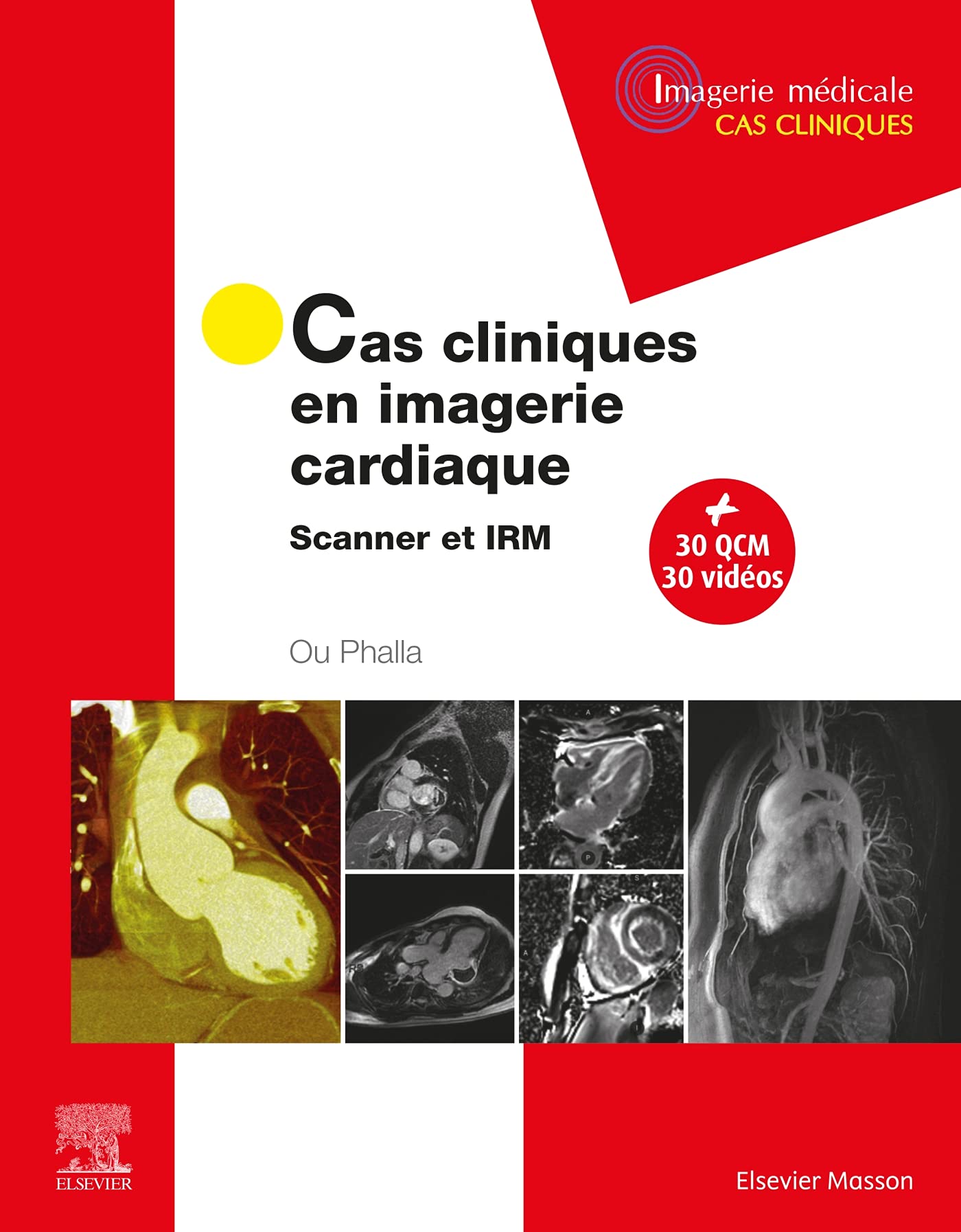 Cas cliniques en imagerie cardiaque: Scanner et IRM
