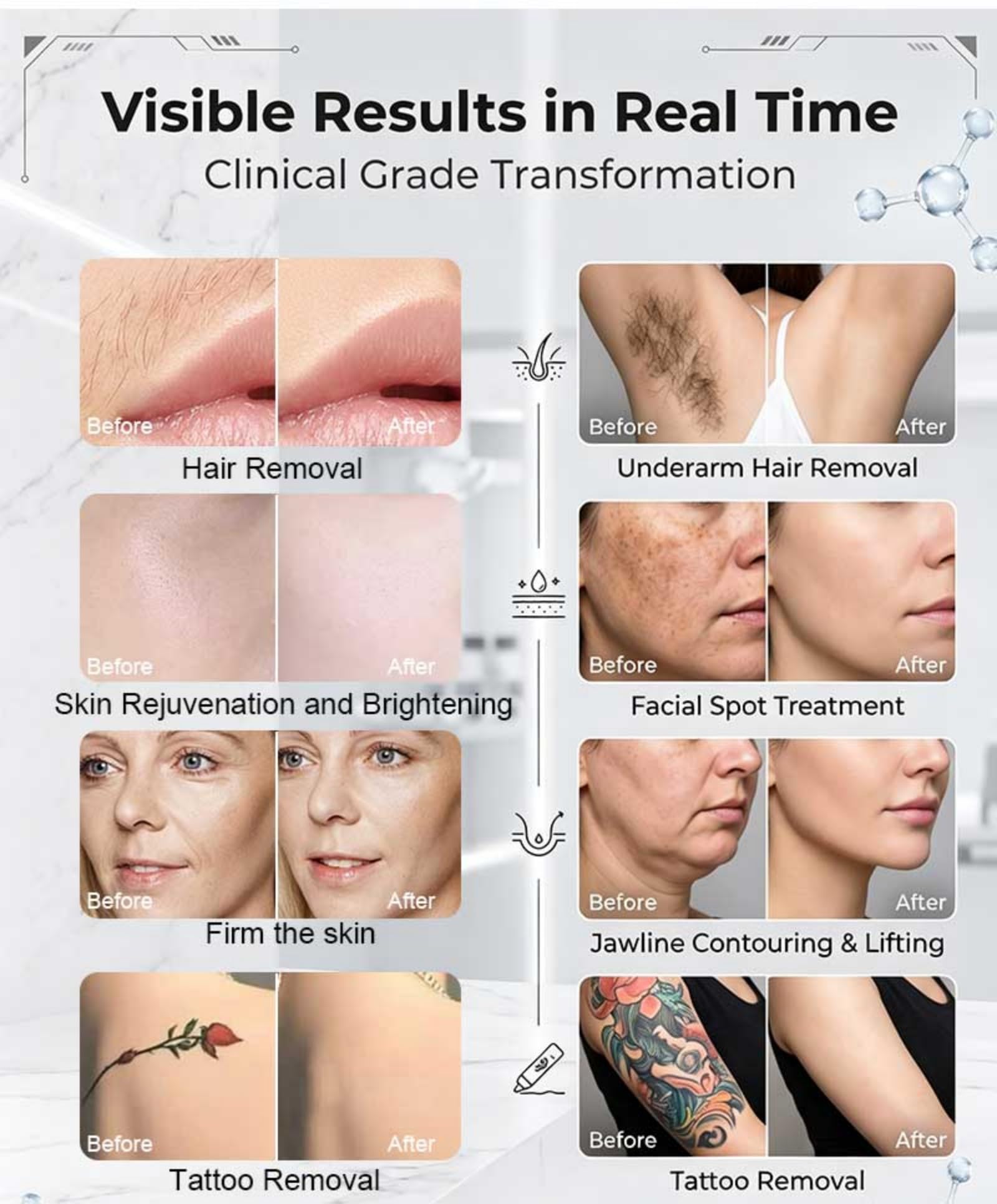 Dispositivo di bellezza 4 in 1 epilazione e ringiovanimento della pelle | Dispositivo di bellezza professionale multifunzionale adatto a viso, corpo, arti, zona bikini e altre aree