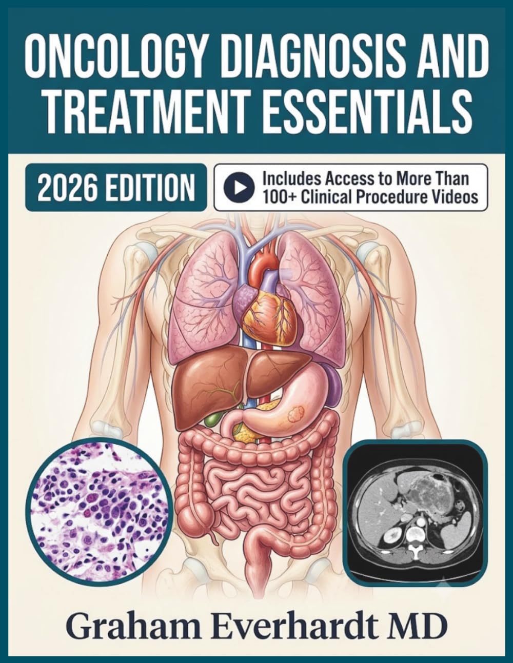 ONCOLOGY DIAGNOSIS AND TREATMENT ESSENTIALS: A Clinical Guide to Cancer Diagnosis, Staging, and Evidence-Based Treatment Planning