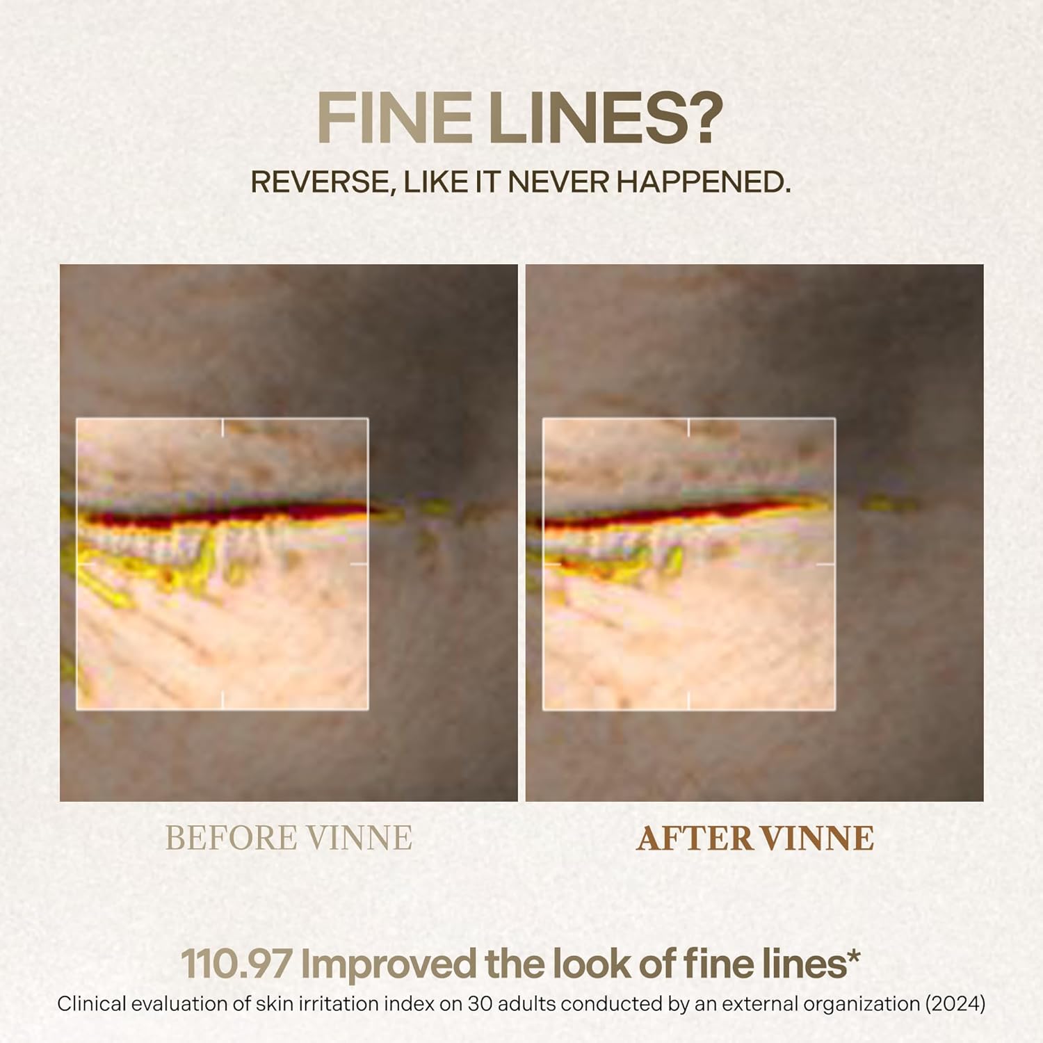 VINNE Signature Bio Deep Collagen Firming Mask – Korean Hydrogel Mask w/ 5,000ppm Ultra-Low Molecular Collagen, Centella Asiatica Exosome, Niacinamide & PDRN – Skin Care Face Mask (4 Sheets, 1.41 oz) - Image 5