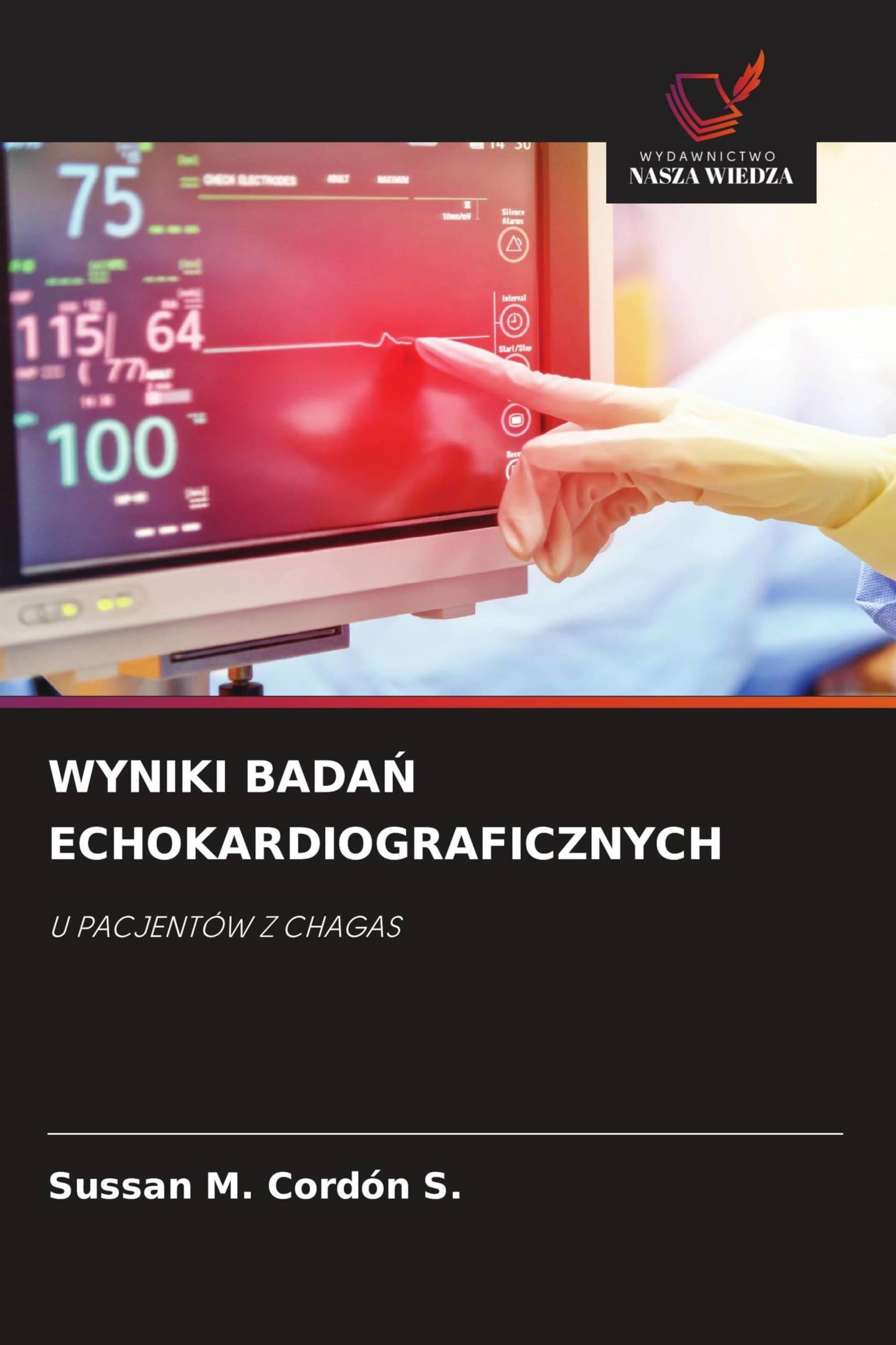 Wyniki BadaŃ Echokardiograficznych: U PACJENTÓW Z CHAGAS