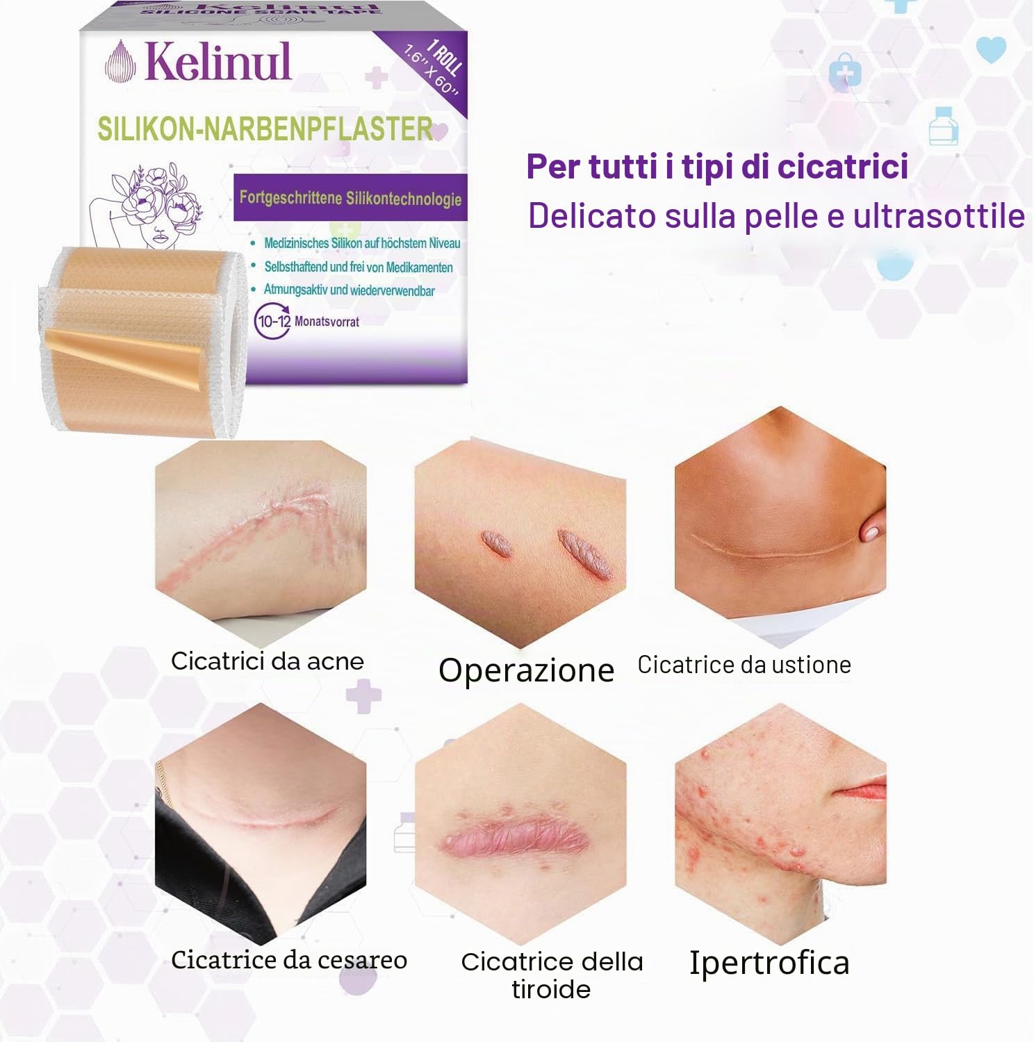 1.5M Fogli di silicone cicatrici 6 mesi di fornitura