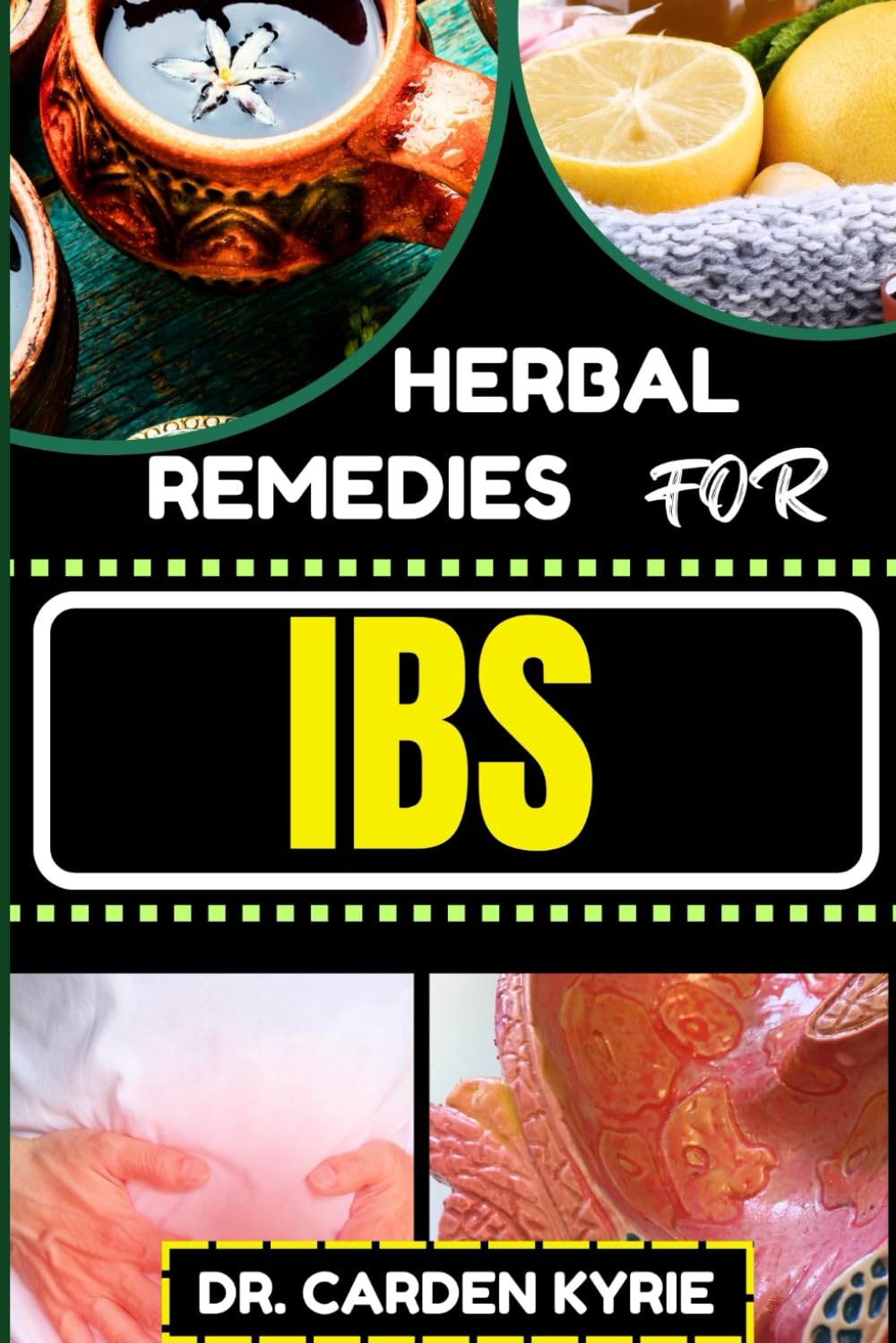 HERBAL REMEDIES FOR IBS: Harmony Through Herbs For Sustainable Relief, Holistic Wellness, Targeted Healing And Reclaiming Gut Health