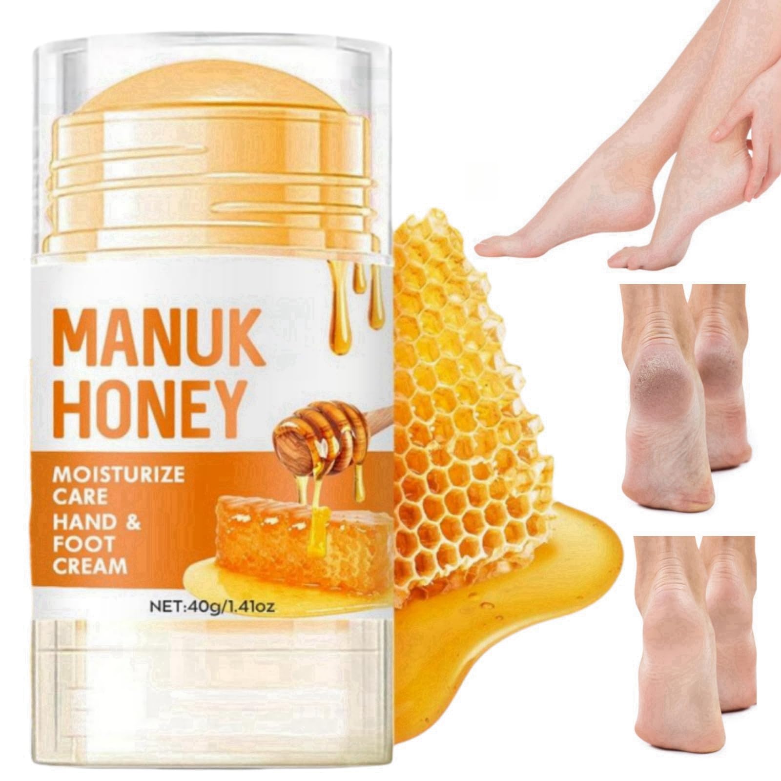 Honey Foot Cream,Hand & Heel Cream for Very Dry Hands & Feet,Cracked Heel Repair Cream,Foot Cream for Cracked Heels and Dry Skin,Foot Care,Urea Foot Cream,Foot Moisturiser,Hard Skin Remover Foot Cream