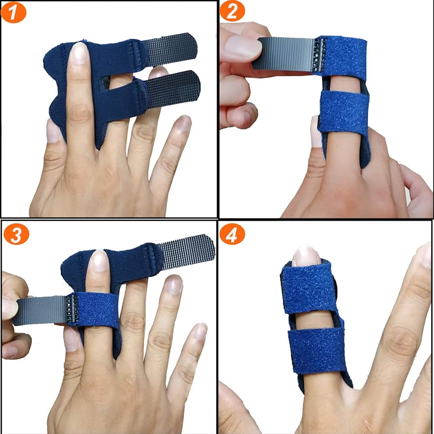 指ブレーストリガー フィンガー スプリント - 壊れた、または曲がった