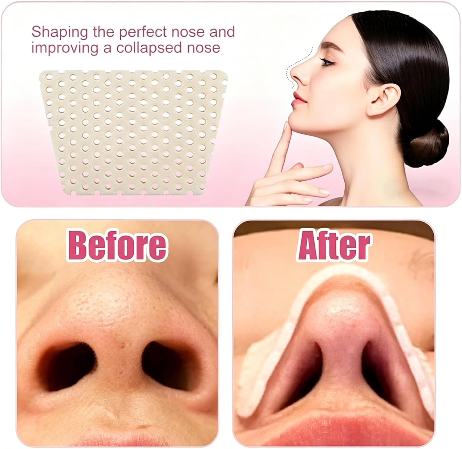 Thermoplastic Nasal Splint & Paper Tape Kit,Alcohol-Free Electricity-Free Nose Fixation Set,Reusable Trapezoidal Nose Clip,Beauty Care Accessories for Rhinoplasty Recovery (6-Piece Set) image 5