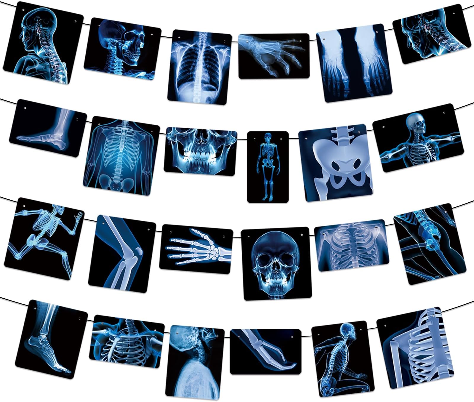 4 Strings X-Ray Skeleton Banner Decorations, Pre-Strung Medical Radiology Anatomy Garland with 24 X-Ray Body Part Images for Doctor Nurse Graduation, Halloween Party, Clinic Classroom Science Décor