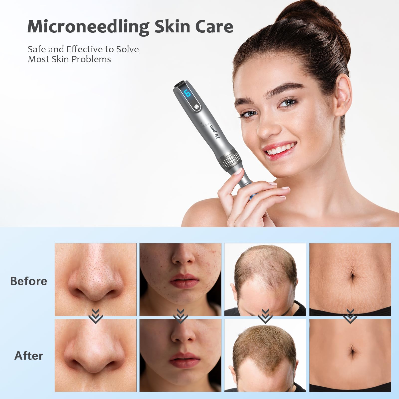 Dr. Pen M8S Microneedling Pen Original Profesional Kit Inalámbrica Microneedle Rostro Cuerpo Crecimiento Cabello Barba 8 Cartuchos