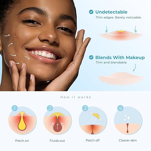 Miniatura 3 de Parches de espinillas para cara y cuerpo, tratamiento durante la noche, parche para acné para zits, puntos, golpes, manchas, espinillas, espinillas,