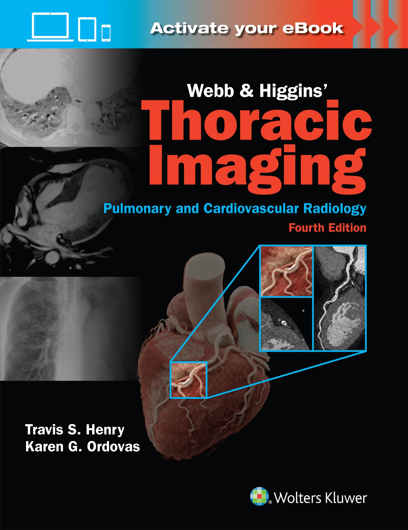 Buy Webb & Higgins Thoracic Imaging: Print + eBook with Multimedia